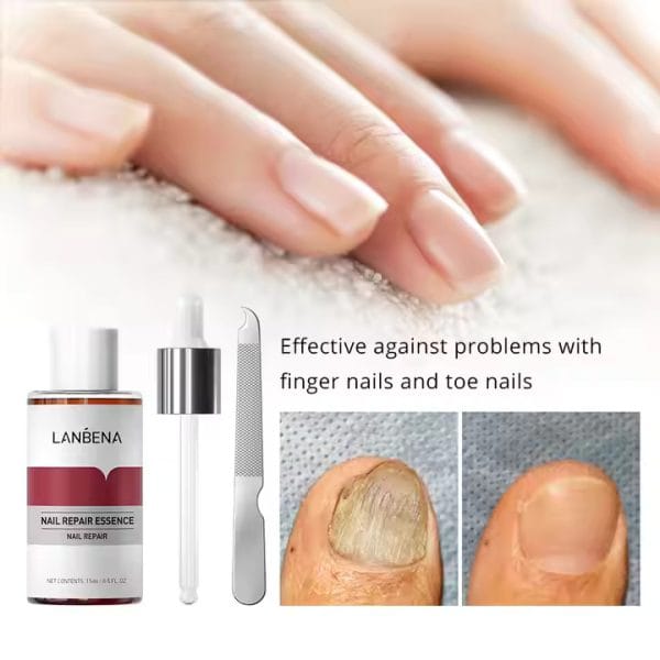 LANBENA Nail Repair Essence for Stronger Nails 15 Ml - Image 2