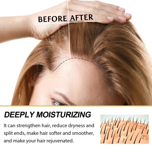 EELHOE Hair Growth Essential Oil Scalp Nourishing Treatment Anti Hair Loss Castor Oil Serum Beauty Health Damaged Hair Repairing - Image 5
