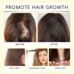 Scalp Repairing Hair Serum Herbal Rosemary Castor Oil Hair Booster Dense Essential Oil Prevent Hair Loss Soft Smoothing Hair Oil - Image 4