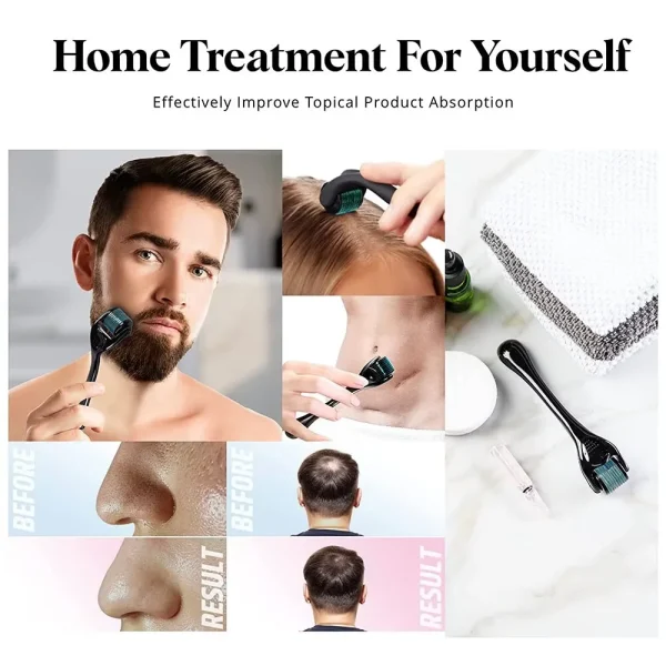 0.25-0.3mm Microneedle for Facial Body Hair Growth Derma Roller for Skin Beard 540 Needles Micro Face Roll Tool Gold Purple - Image 5