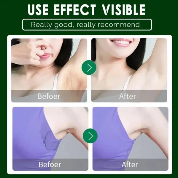 Body Odor Removal Antiperspirant Hair Inhibitor Long Lasting Effect Sweat Odor Deodorant Fresh Pleasant Rose Fragrance Body Care - Image 3